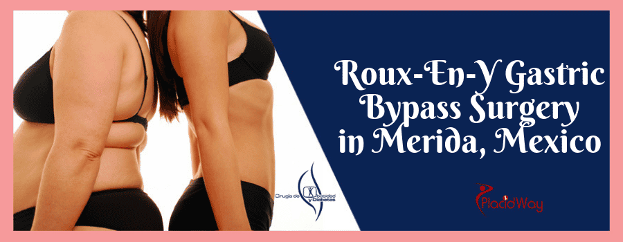 Roux-en-Y Gastric Bypass in Merida, Mexico